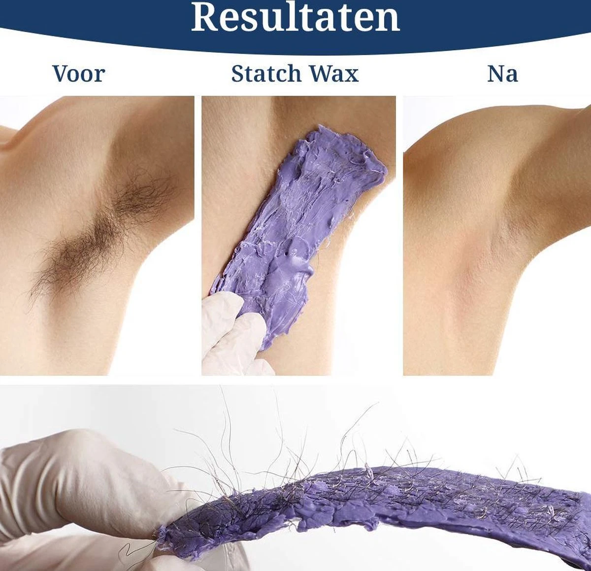 STATCH Wax Apparaat Ontharing Set Met 500 Gram Wax Bonen En 25 Houten Spatels - 4 STATCH Wax Apparaat Ontharing Set Met 500 Gram Wax Bonen En 25 Houten Spatels - - Afbeelding 4