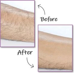 EPC® Duo Crystal Hair Removal Pad - Ontharings Pad - Pijnloos Ontharen - Kristal Haarverwijderaar - Scrubi - Ontharing Eraser Kristalpad - Bleame - Armen Benen Bikinilijn - Roze 7 EPC® Duo Crystal Hair Removal Pad - Ontharings Pad - Pijnloos Ontharen - Kristal Haarverwijderaar - Scrubi - Ontharing Eraser Kristalpad - Bleame - Armen Benen Bikinilijn - Roze -Verzorgingsproductenwinkel 1200x1177