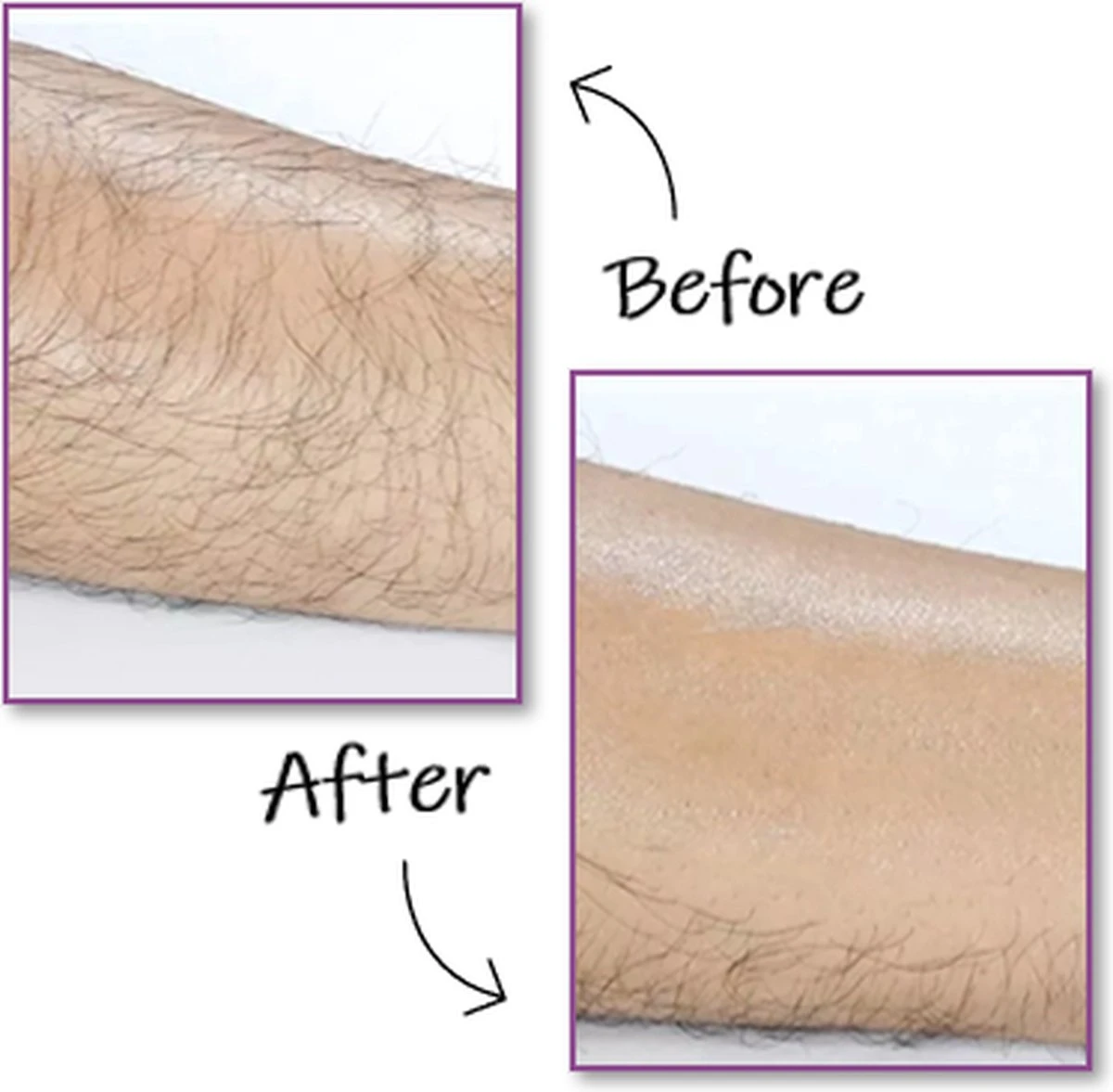 EPC® Duo Crystal Hair Removal Pad - Ontharings Pad - Pijnloos Ontharen - Kristal Haarverwijderaar - Scrubi - Ontharing Eraser Kristalpad - Bleame - Armen Benen Bikinilijn - Roze 4 EPC® Duo Crystal Hair Removal Pad - Ontharings Pad - Pijnloos Ontharen - Kristal Haarverwijderaar - Scrubi - Ontharing Eraser Kristalpad - Bleame - Armen Benen Bikinilijn - Roze - Afbeelding 4