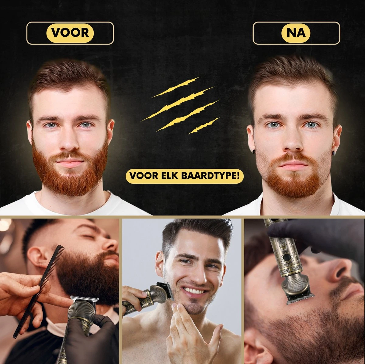 6-in-1 Baardtrimmer Mannen - Trimmer Voor Baard En Lichaam - Incl. 6 Opzetstukken - Bodygroomer Mannen - Bodytrimmer Heren - Tondeuse - 0.5-15MM - Neus En Oor 12 6-in-1 Baardtrimmer Mannen - Trimmer Voor Baard En Lichaam - Incl. 6 Opzetstukken - Bodygroomer Mannen - Bodytrimmer Heren - Tondeuse - 0.5-15MM - Neus En Oor - Afbeelding 12