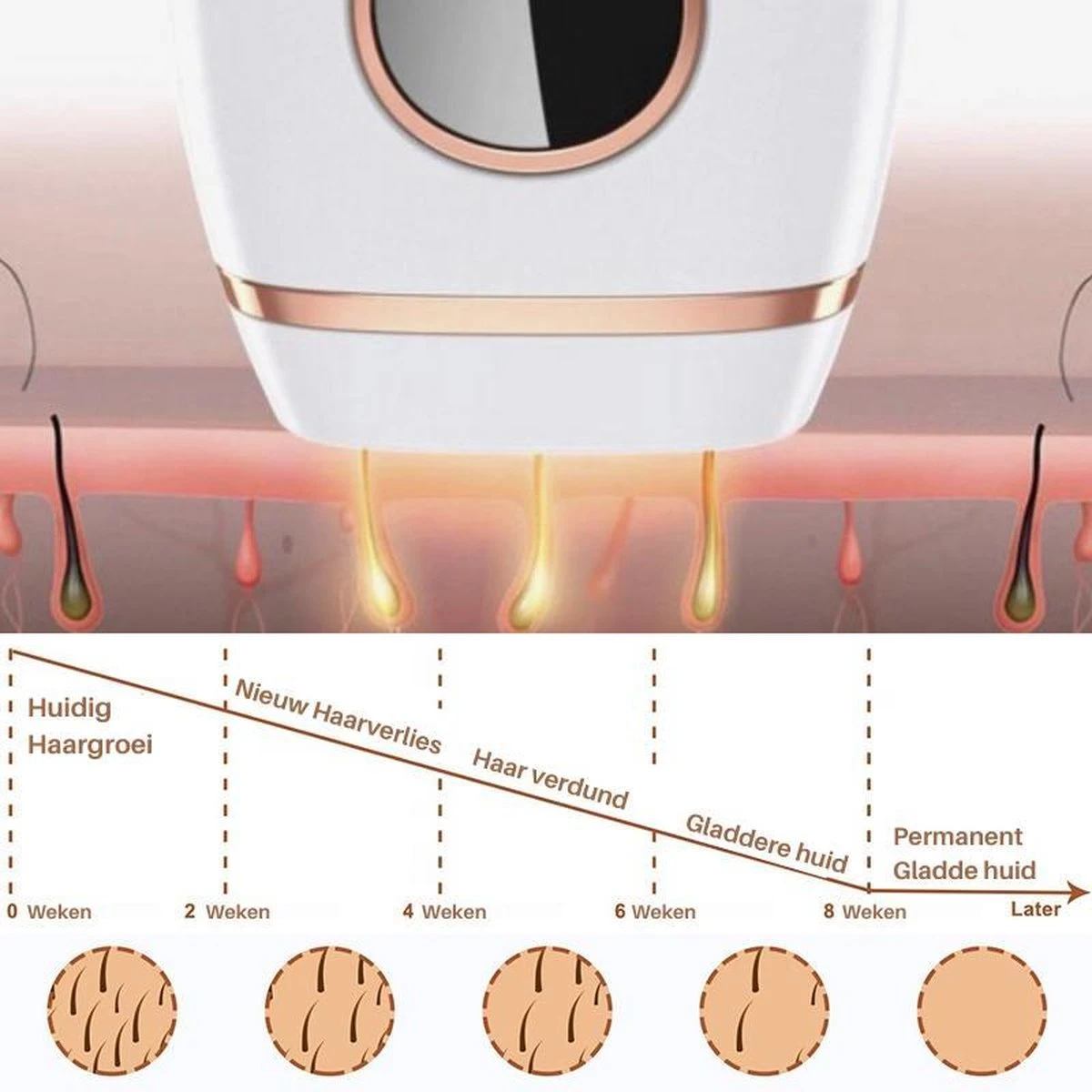 Dyla IPL Ontharingsapparaat Hair Removal - Pijnloze Haar Verwijderaar - Lichtontharing - 999.999 Flitsen - Wit 3 Dyla IPL Ontharingsapparaat Hair Removal - Pijnloze Haar Verwijderaar - Lichtontharing - 999.999 Flitsen - Wit - Afbeelding 3