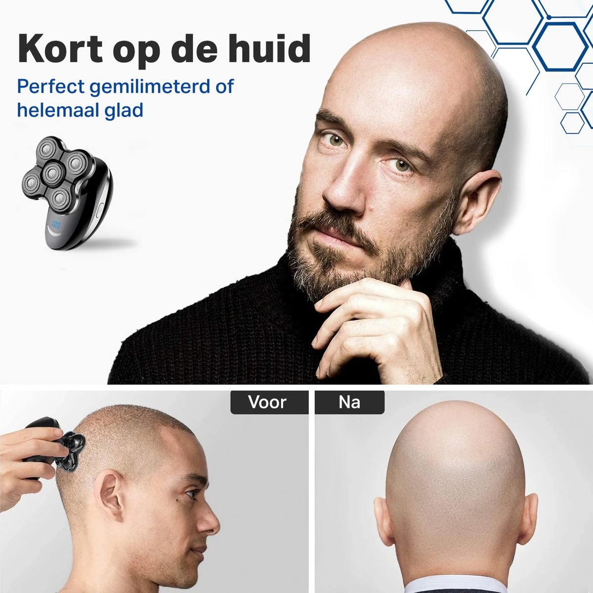 Vivid Green 5-in-1 Scheerapparaat Mannen - Trimmer - Nat En Droog Scheren - Incl. 5 Opzetstukken - Draadloos 6 Vivid Green 5-in-1 Scheerapparaat Mannen - Trimmer - Nat En Droog Scheren - Incl. 5 Opzetstukken - Draadloos - Afbeelding 6