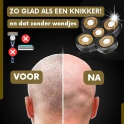 6-in-1 Scheerapparaat Mannen + Extra Scheerkop – Trimmer - Sansbeauté Skull Edition Classic - Electric Face & Head Shaver - Hoofd Kaal Scheren – Nat & Droog - Elektrisch 30 6-in-1 Scheerapparaat Mannen + Extra Scheerkop – Trimmer - Sansbeauté Skull Edition Classic - Electric Face & Head Shaver - Hoofd Kaal Scheren – Nat & Droog - Elektrisch -Verzorgingsproductenwinkel 1200x1200 1597