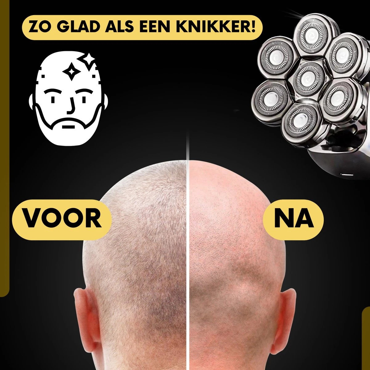 6-in-1 Scheerapparaat Mannen + Extra Scheerkop – Trimmer - Skull Edition PRO - Nat & Droog - Face En Head Shaver – Hoofd Kaal Scheren - Draadloos Opladen - Opzetstukken - Incl. E-Book 6 6-in-1 Scheerapparaat Mannen + Extra Scheerkop – Trimmer - Skull Edition PRO - Nat & Droog - Face En Head Shaver – Hoofd Kaal Scheren - Draadloos Opladen - Opzetstukken - Incl. E-Book - Afbeelding 6