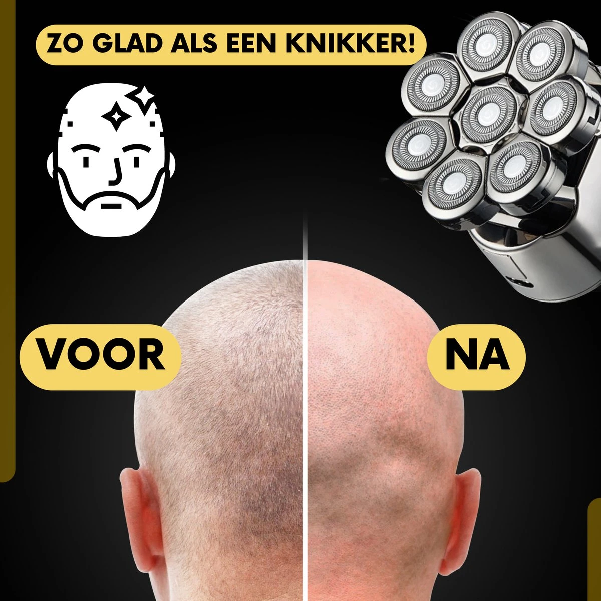 6-in-1 Scheerapparaat Mannen – Trimmer - Skull Edition PRO | 8 Blade - Nat & Droog - Face En Head Shaver – Hoofd Kaal Scheren - USB - Opzetstukken - Incl. E-Book 10 6-in-1 Scheerapparaat Mannen – Trimmer - Skull Edition PRO | 8 Blade - Nat & Droog - Face En Head Shaver – Hoofd Kaal Scheren - USB - Opzetstukken - Incl. E-Book - Afbeelding 10