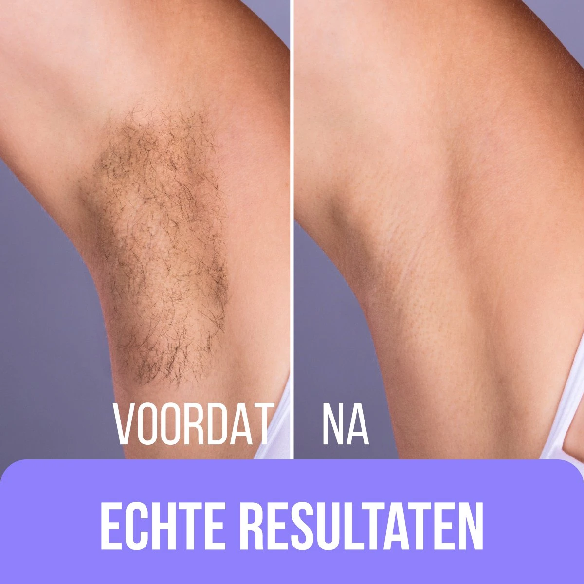 Premium Wax Set Inclusief 400gr Wax Bonen - Pre- & After-Wax Spray - 20 Aanbreng Spatels 7 Premium Wax Set Inclusief 400gr Wax Bonen - Pre- & After-Wax Spray - 20 Aanbreng Spatels - Afbeelding 7