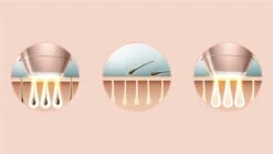 Philips Lumea Prestige 9000 Series BRI957/00 - IPL Ontharingsapparaat 33 Philips Lumea Prestige 9000 Series BRI957/00 - IPL Ontharingsapparaat -Verzorgingsproductenwinkel 1200x675 53