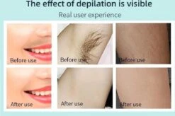 Aruvaya [Premium] - IPL Laser Ontharingsapparaat - 1.000.000 Flitsen! -Verzorgingsproductenwinkel 1200x798 3